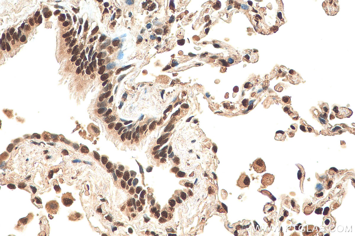 Immunohistochemistry (IHC) staining of human lung tissue using SNRPD2 Polyclonal antibody (14789-1-AP)