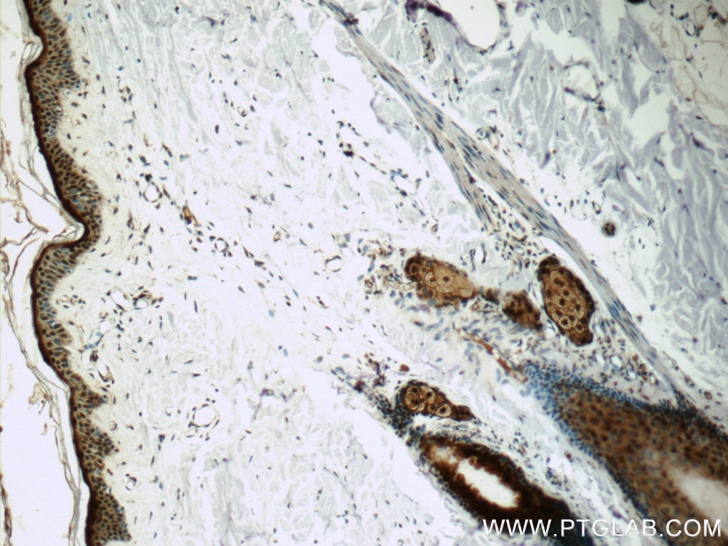 Immunohistochemistry (IHC) staining of human skin tissue using SNRPD2 Polyclonal antibody (14789-1-AP)