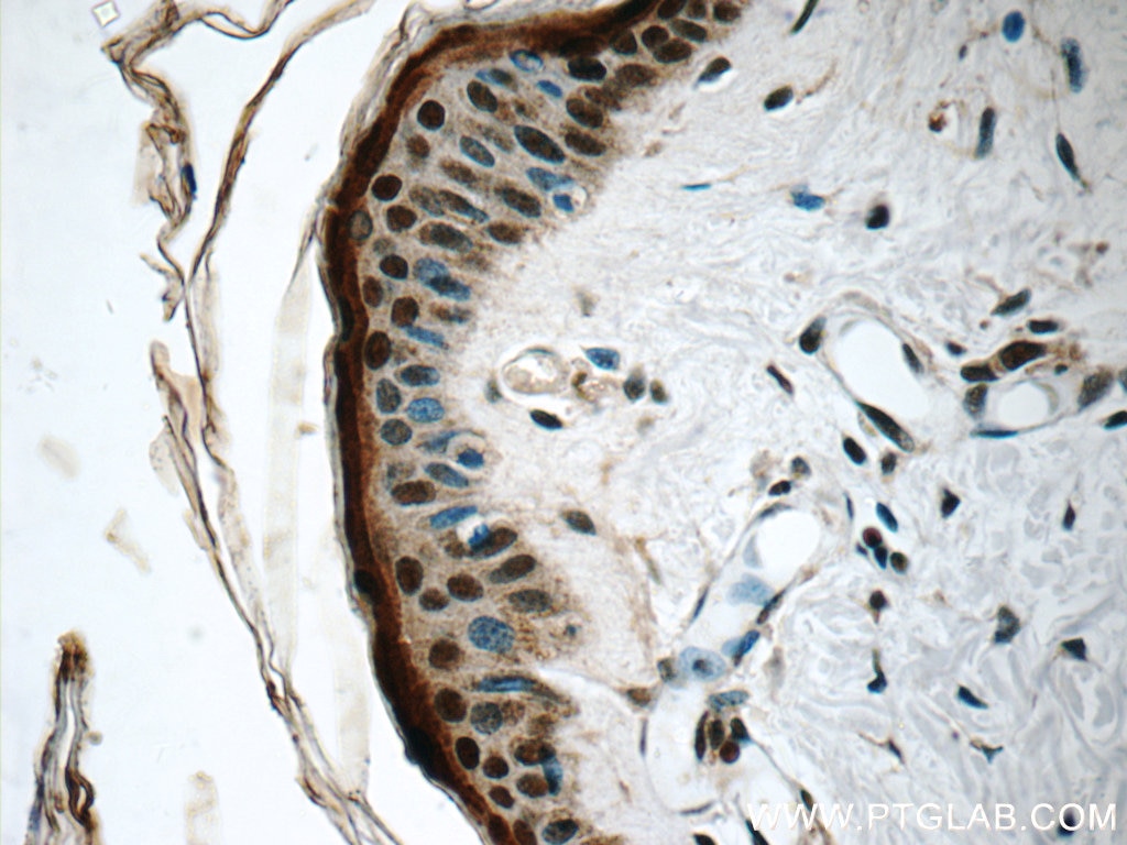 Immunohistochemistry (IHC) staining of human skin tissue using SNRPD2 Polyclonal antibody (14789-1-AP)