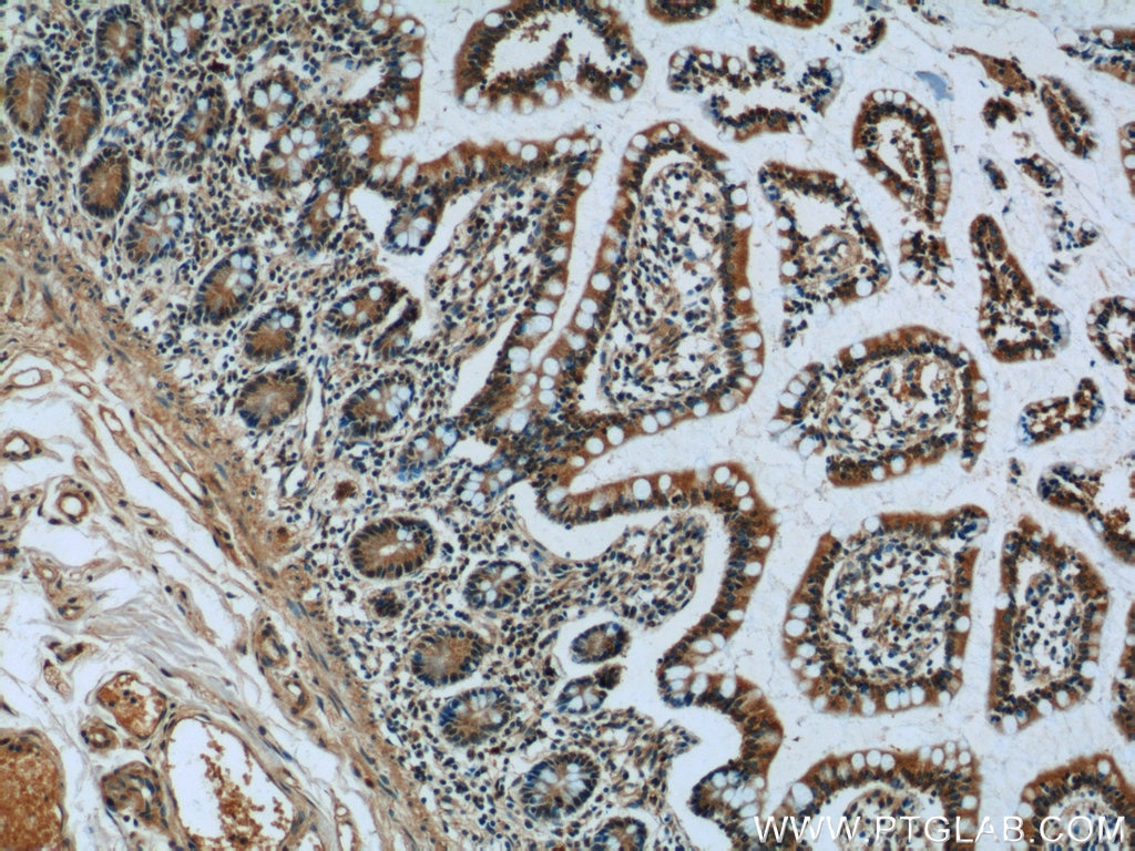 IHC staining of human small intestine using 10379-1-AP