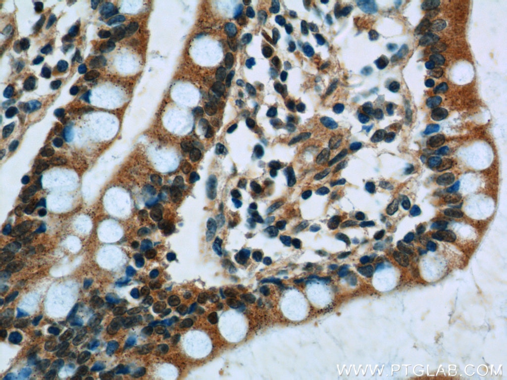 Immunohistochemistry (IHC) staining of human small intestine tissue using SNRPD3 Polyclonal antibody (10379-1-AP)