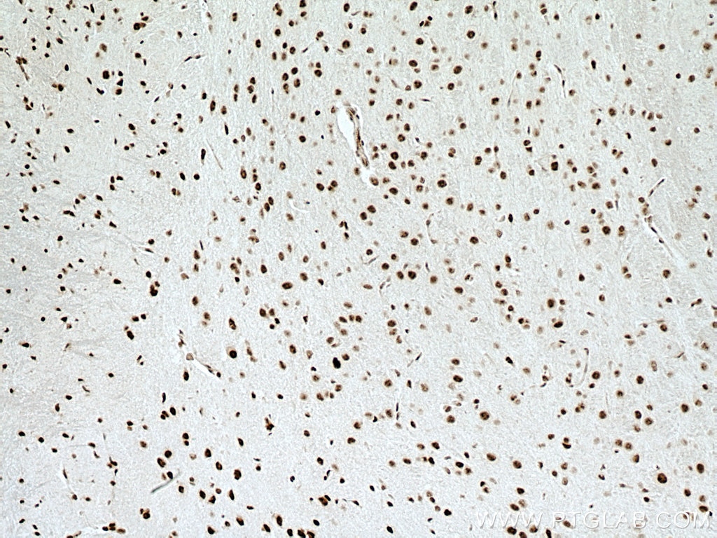 Immunohistochemistry (IHC) staining of mouse brain tissue using SNRPE Polyclonal antibody (20407-1-AP)