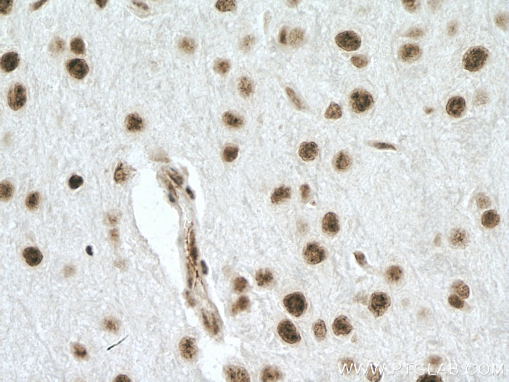 Immunohistochemistry (IHC) staining of mouse brain tissue using SNRPE Polyclonal antibody (20407-1-AP)