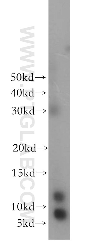 Western Blot (WB) analysis of human placenta tissue using SNRPE Polyclonal antibody (20407-1-AP)
