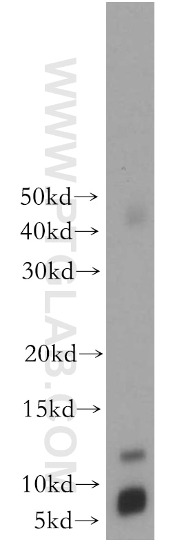 Western Blot (WB) analysis of human brain tissue using SNRPE Polyclonal antibody (20407-1-AP)