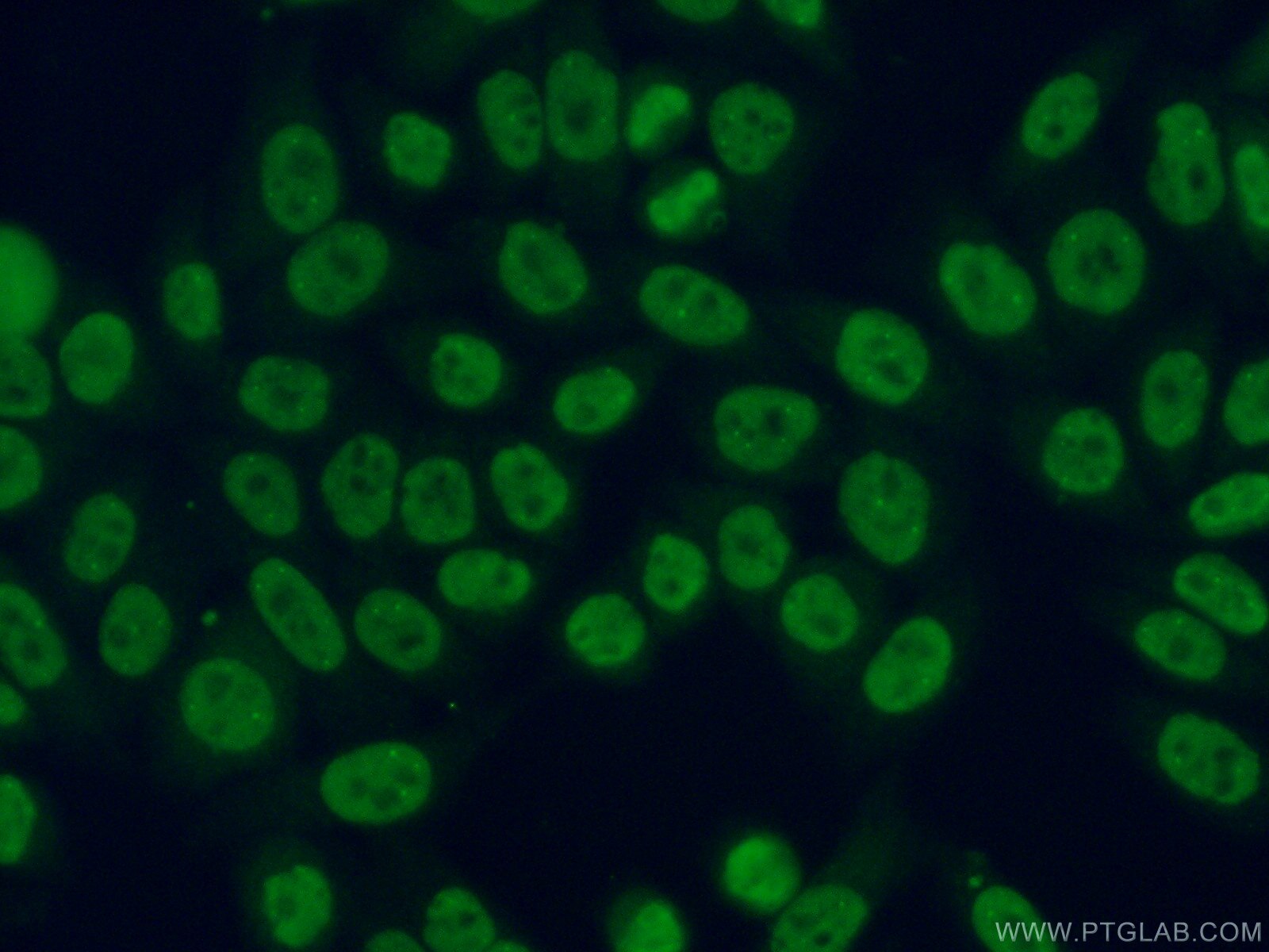 Immunofluorescence (IF) / fluorescent staining of HeLa cells using SNRPF Polyclonal antibody (14977-1-AP)