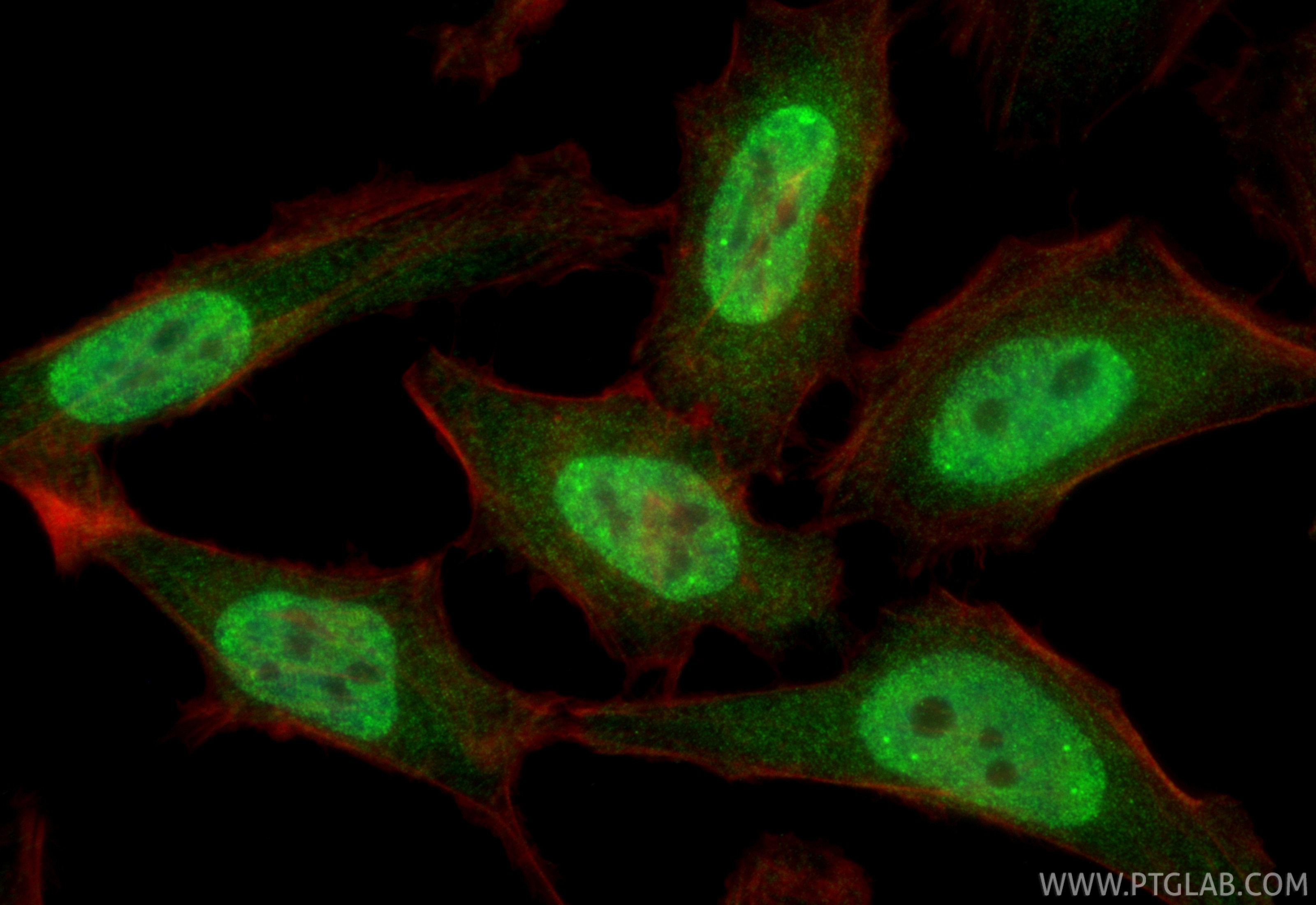 Immunofluorescence (IF) / fluorescent staining of HeLa cells using SNRPF Polyclonal antibody (14977-1-AP)