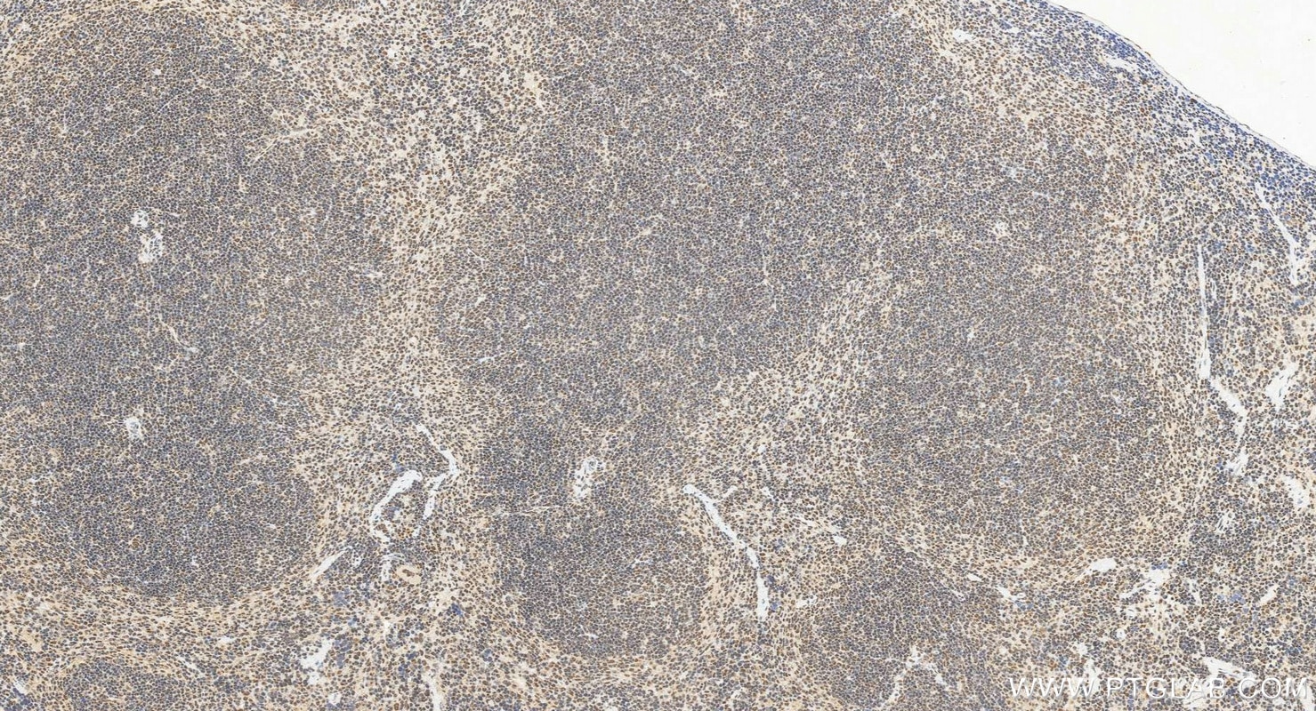 Immunohistochemistry (IHC) staining of mouse spleen tissue using SNRPF Polyclonal antibody (14977-1-AP)