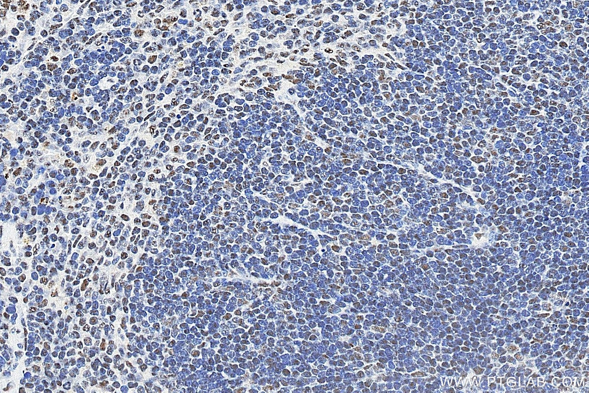 Immunohistochemistry (IHC) staining of mouse spleen tissue using SNRPF Polyclonal antibody (14977-1-AP)