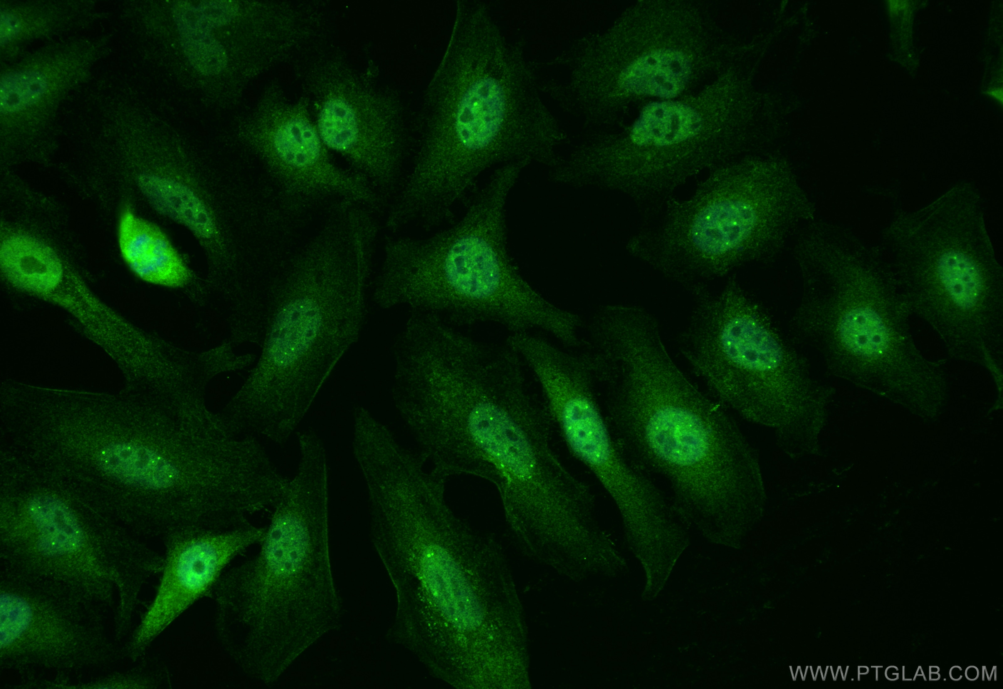 Immunofluorescence (IF) / fluorescent staining of HeLa cells using SNRPN Polyclonal antibody (11070-1-AP)
