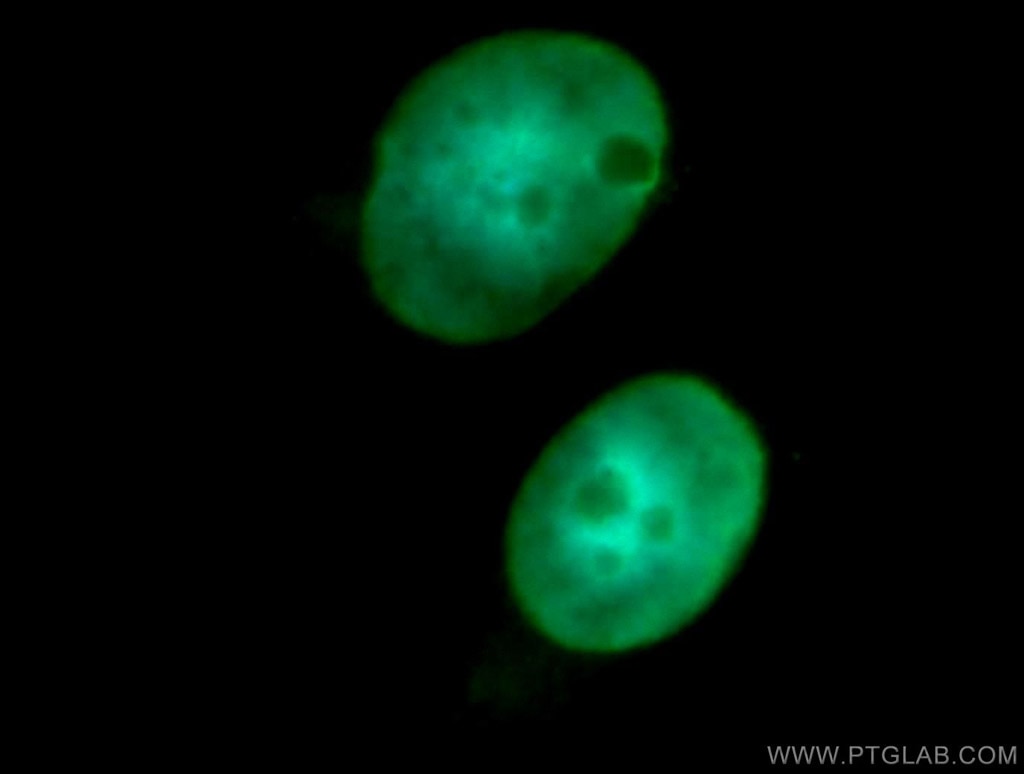Immunofluorescence (IF) / fluorescent staining of SH-SY5Y cells using SNRPN Polyclonal antibody (11070-1-AP)
