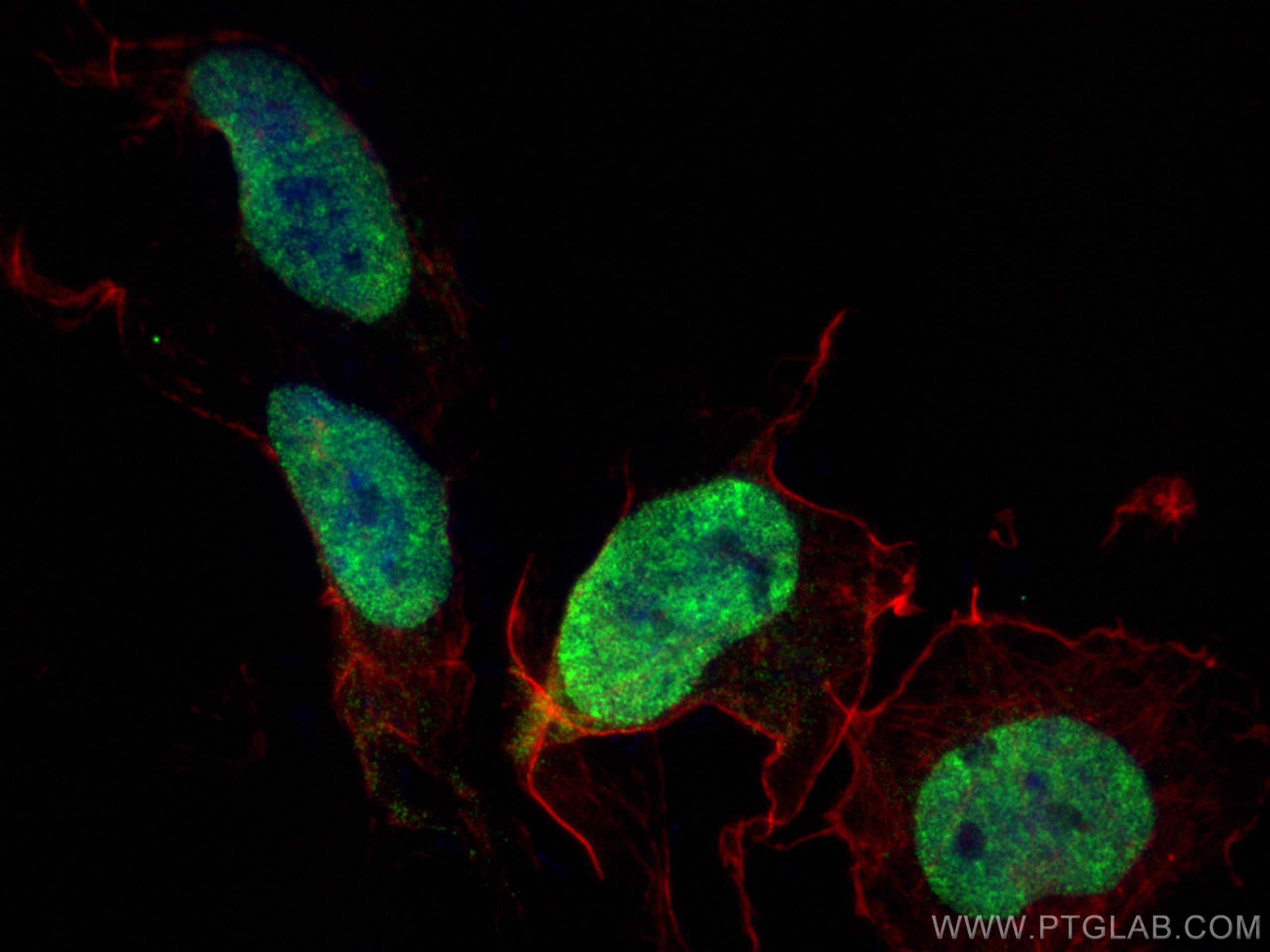 Immunofluorescence (IF) / fluorescent staining of SH-SY5Y cells using SNRPN/SNRPB Monoclonal antibody (67280-1-Ig)