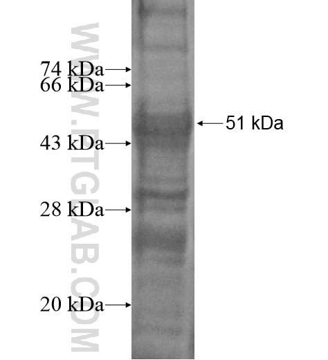 SNRPN fusion protein Ag14217 SDS-PAGE