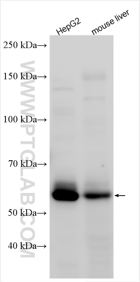 Western Blot (WB) analysis of various lysates using SNTB1-Specific Polyclonal antibody (19719-1-AP)