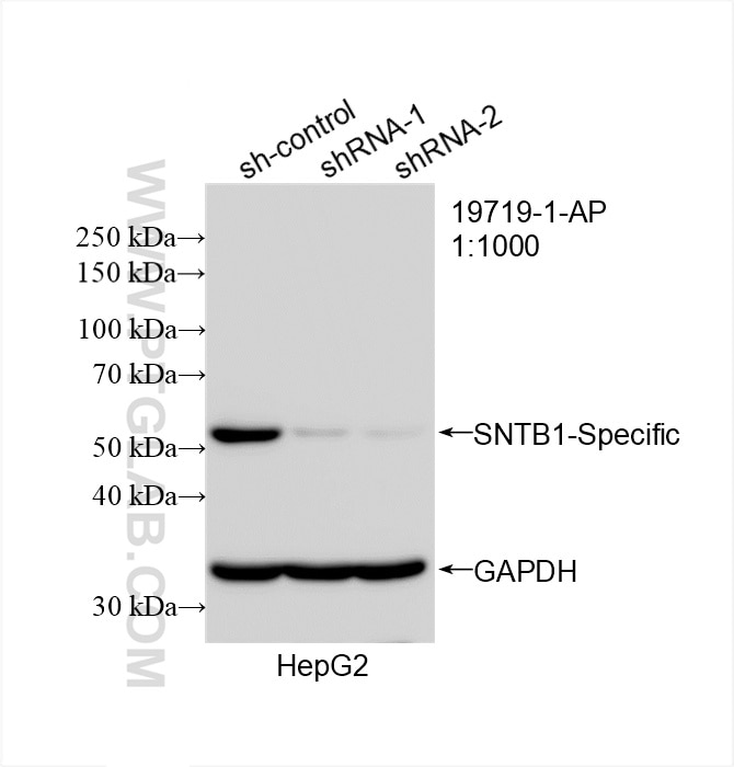 Western Blot (WB) analysis of HepG2 cells using SNTB1-Specific Polyclonal antibody (19719-1-AP)