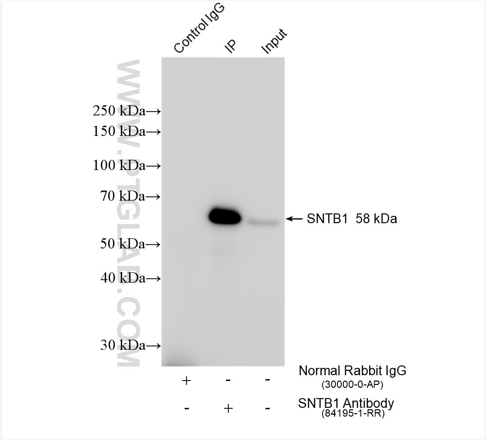 Immunoprecipitation (IP) experiment of HepG2 cells using SNTB1-Specific Recombinant antibody (84195-1-RR)
