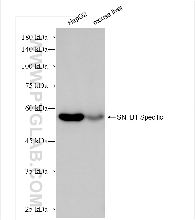 Western Blot (WB) analysis of various lysates using SNTB1-Specific Recombinant antibody (84195-1-RR)