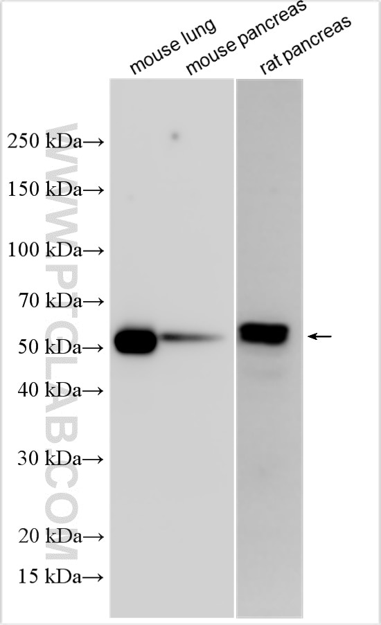 Western Blot (WB) analysis of various lysates using SNTB2 Polyclonal antibody (19027-1-AP)