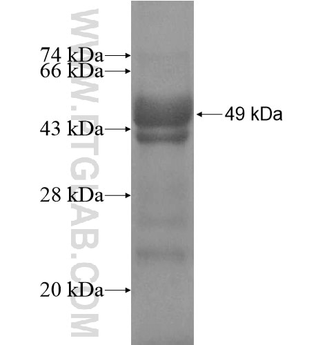 SNTB2 fusion protein Ag13504 SDS-PAGE