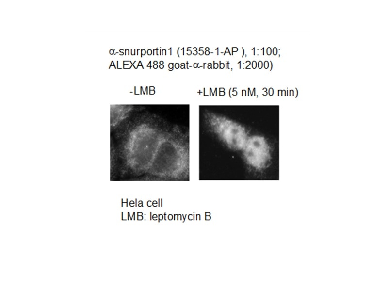 Immunofluorescence (IF) / fluorescent staining of HeLa cells using SNUPN Polyclonal antibody (15358-1-AP)