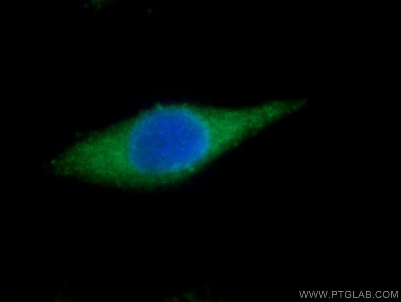 Immunofluorescence (IF) / fluorescent staining of HeLa cells using SNUPN Polyclonal antibody (15358-1-AP)