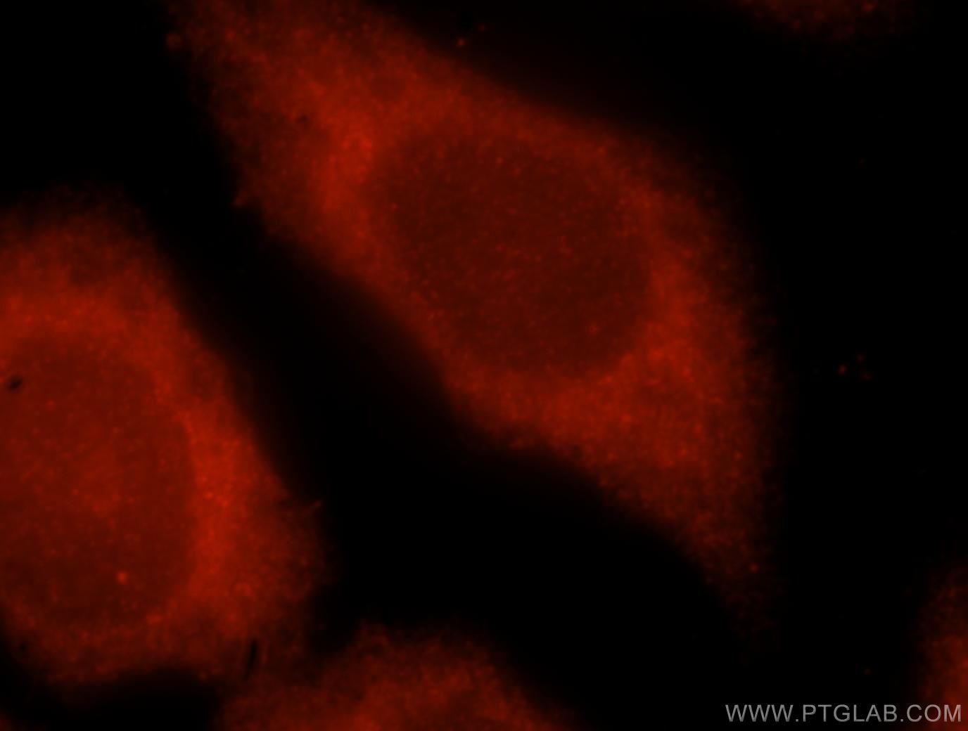 Immunofluorescence (IF) / fluorescent staining of MCF-7 cells using SNUPN Polyclonal antibody (15358-1-AP)