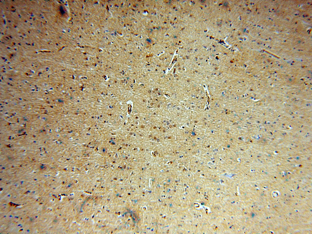 Immunohistochemistry (IHC) staining of human brain tissue using SNUPN Polyclonal antibody (15358-1-AP)