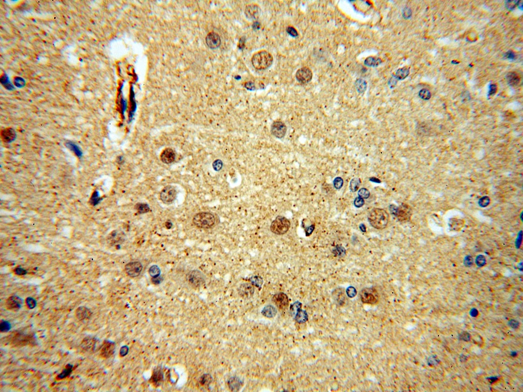 Immunohistochemistry (IHC) staining of human brain tissue using SNUPN Polyclonal antibody (15358-1-AP)