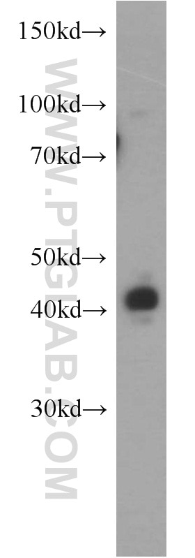 Western Blot (WB) analysis of HeLa cells using SNUPN Polyclonal antibody (15358-1-AP)