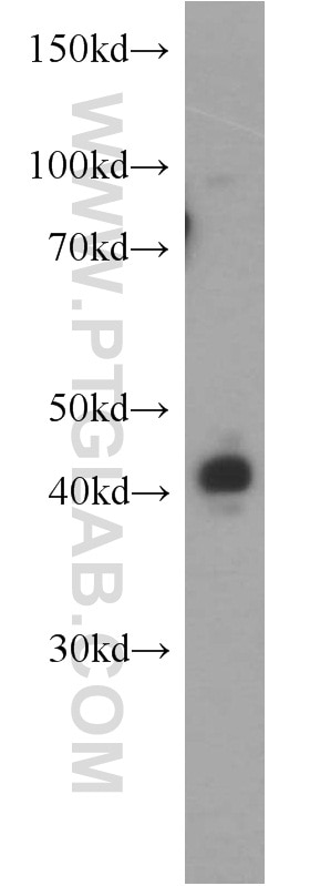 WB analysis of HeLa using 15358-1-AP