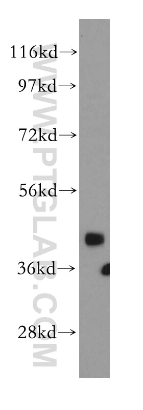 Western Blot (WB) analysis of HeLa cells using SNUPN Polyclonal antibody (15358-1-AP)