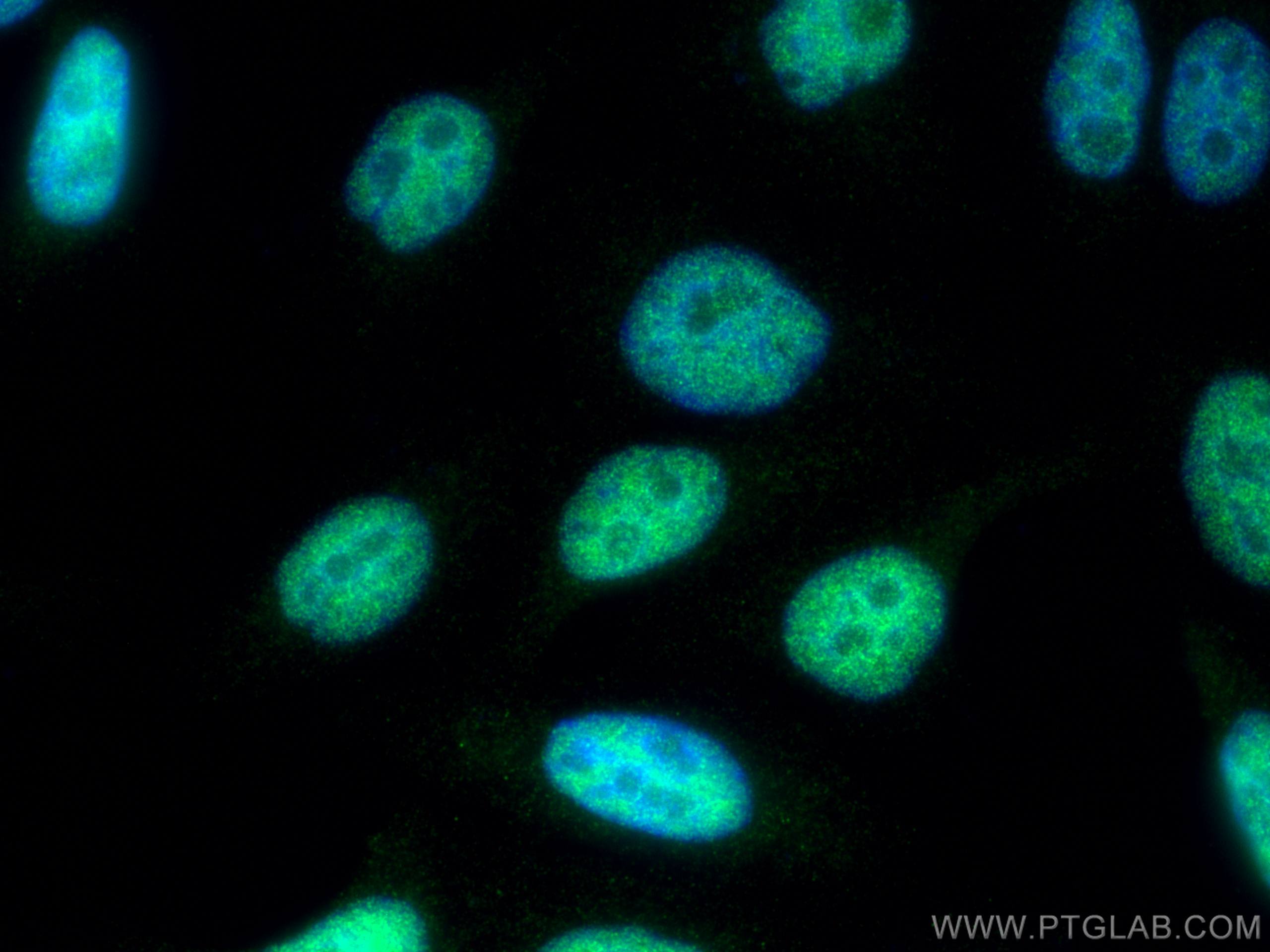 Immunofluorescence (IF) / fluorescent staining of HepG2 cells using SNW1 Polyclonal antibody (25926-1-AP)