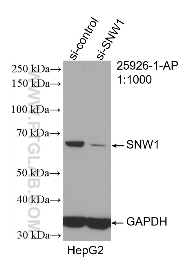 Western Blot (WB) analysis of HepG2 cells using SNW1 Polyclonal antibody (25926-1-AP)