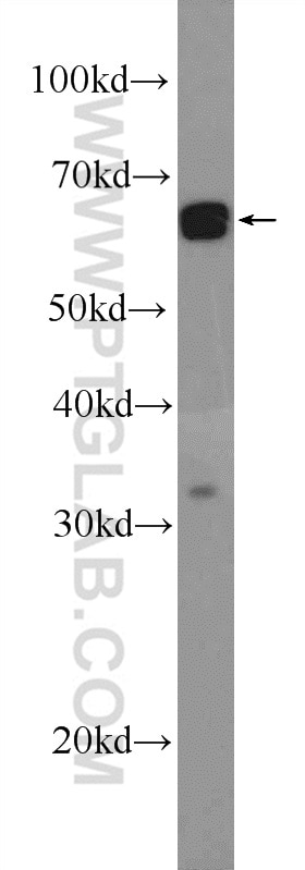 Western Blot (WB) analysis of HepG2 cells using SNW1 Polyclonal antibody (25926-1-AP)