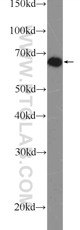 Western Blot (WB) analysis of MCF-7 cells using SNW1 Polyclonal antibody (25926-1-AP)