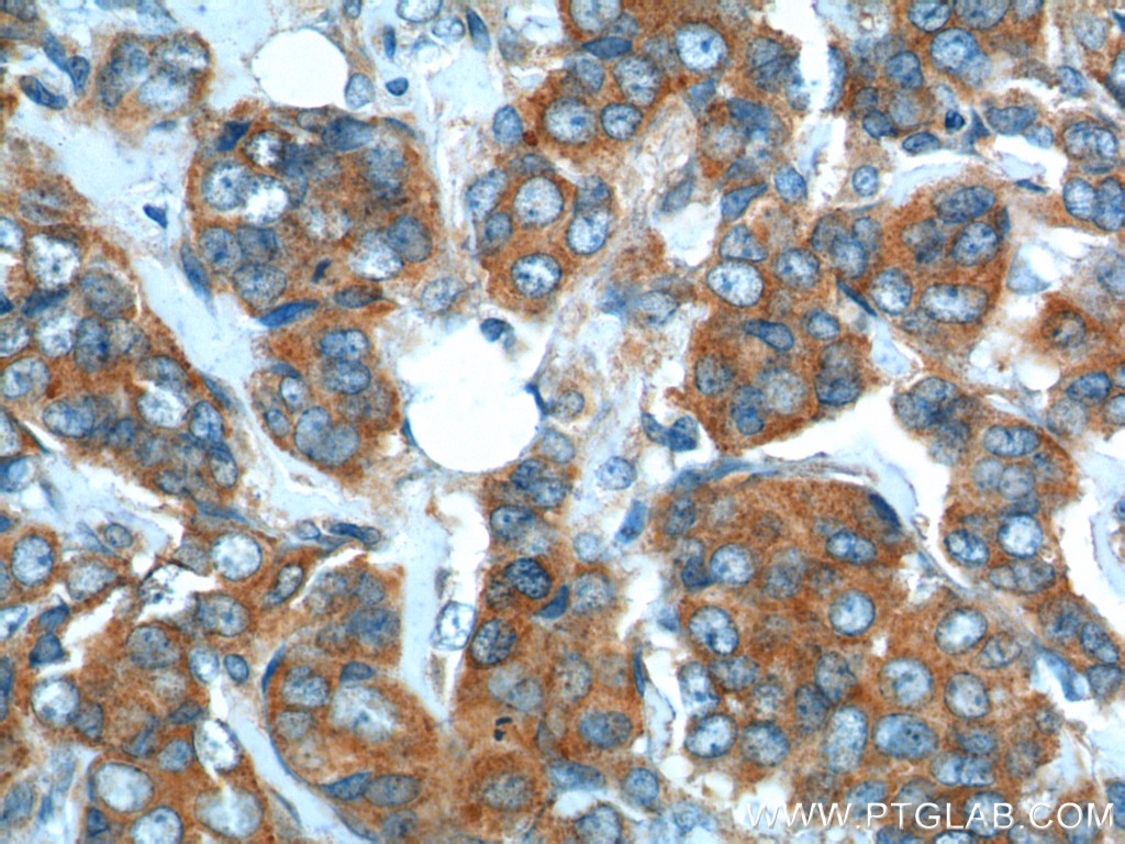 SNX1 Polyclonal antibody