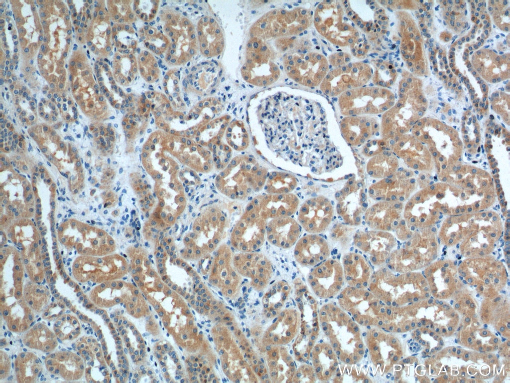 Immunohistochemistry (IHC) staining of human kidney tissue using SNX1 Polyclonal antibody (10304-1-AP)
