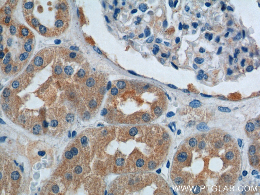 Immunohistochemistry (IHC) staining of human kidney tissue using SNX1 Polyclonal antibody (10304-1-AP)