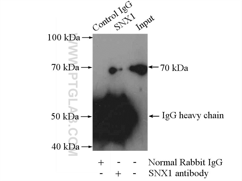 Immunoprecipitation (IP) experiment of HeLa cells using SNX1 Polyclonal antibody (10304-1-AP)
