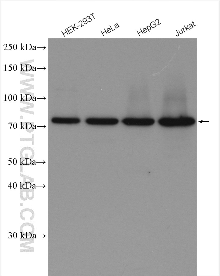 Western Blot (WB) analysis of various lysates using SNX1 Polyclonal antibody (10304-1-AP)