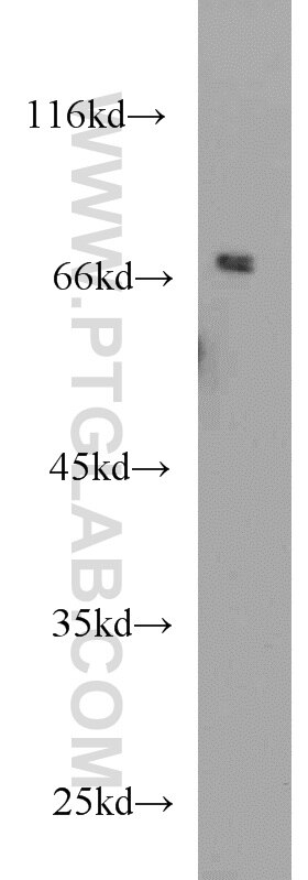 SNX1 Polyclonal antibody