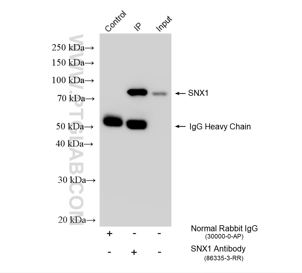 Immunoprecipitation (IP) experiment of HeLa cells using SNX1 Recombinant antibody (86335-3-RR)