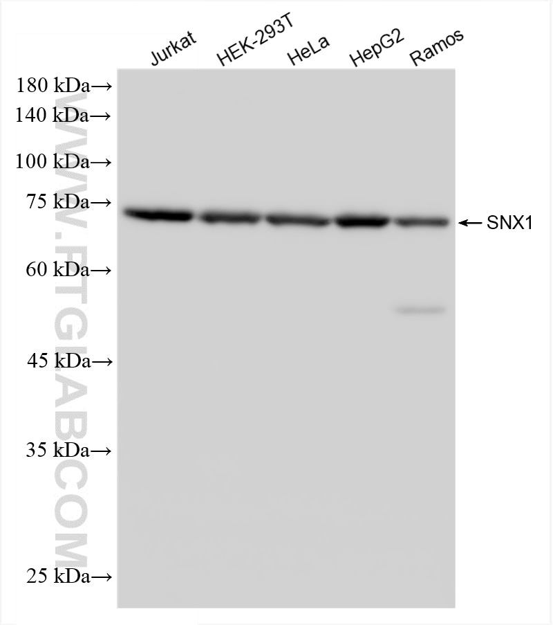 Western Blot (WB) analysis of various lysates using SNX1 Recombinant antibody (86335-3-RR)