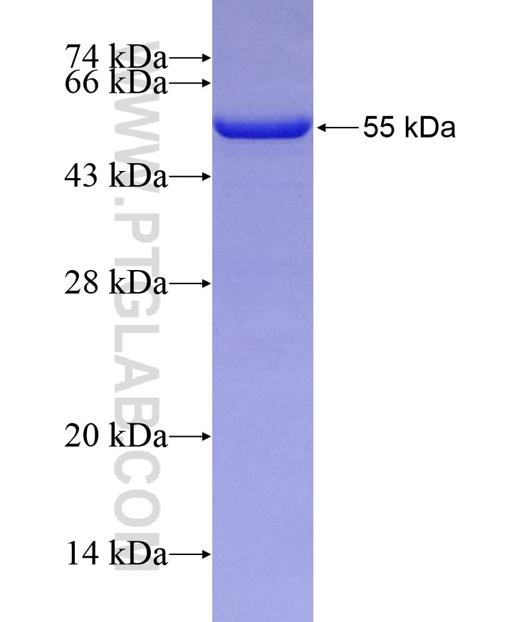 SNX1 fusion protein Ag0499 SDS-PAGE