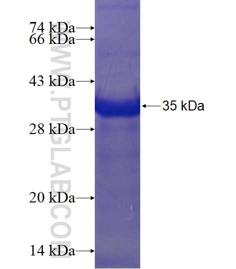 SNX1 fusion protein Ag17603 SDS-PAGE