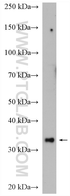 Western Blot (WB) analysis of HeLa cells using SNX11 Polyclonal antibody (14953-1-AP)