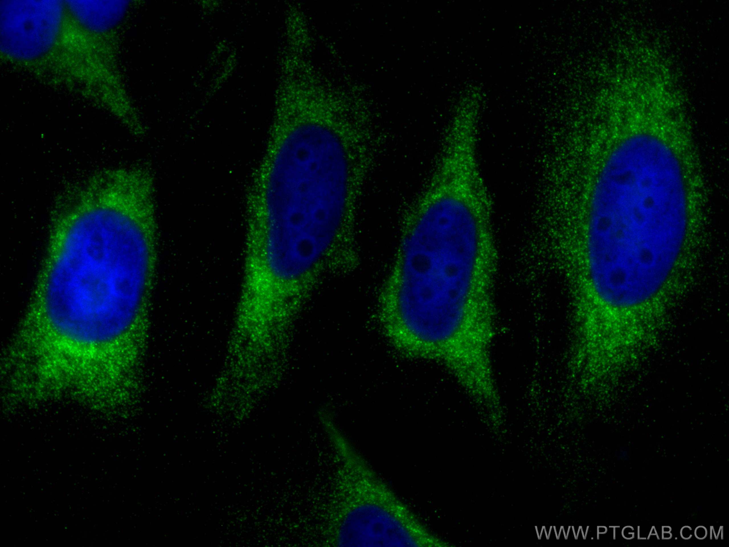 Immunofluorescence (IF) / fluorescent staining of HeLa cells using SNX12 Polyclonal antibody (12374-1-AP)