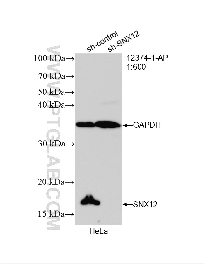 Western Blot (WB) analysis of HeLa cells using SNX12 Polyclonal antibody (12374-1-AP)