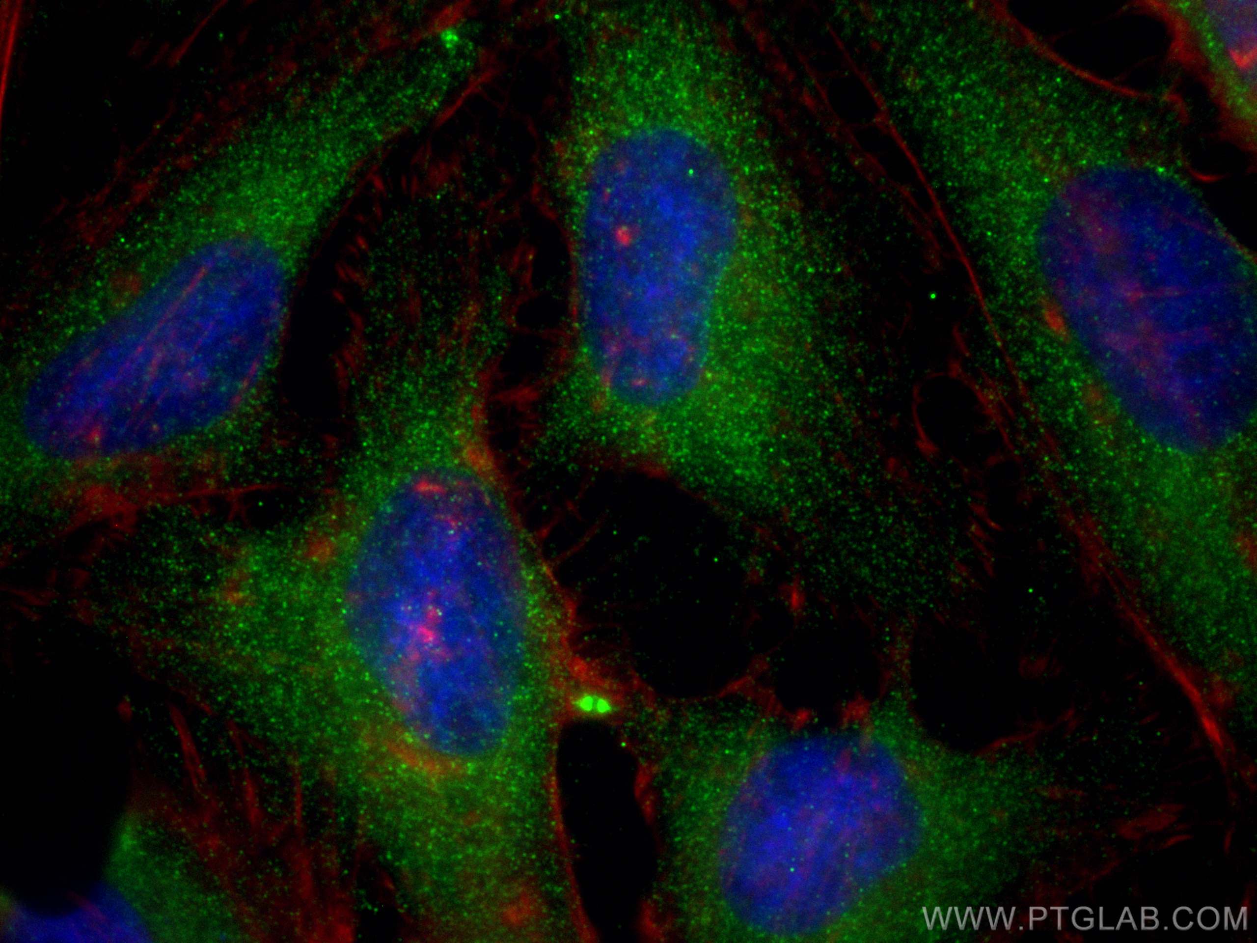 Immunofluorescence (IF) / fluorescent staining of HeLa cells using SNX12 Monoclonal antibody (68260-1-Ig)