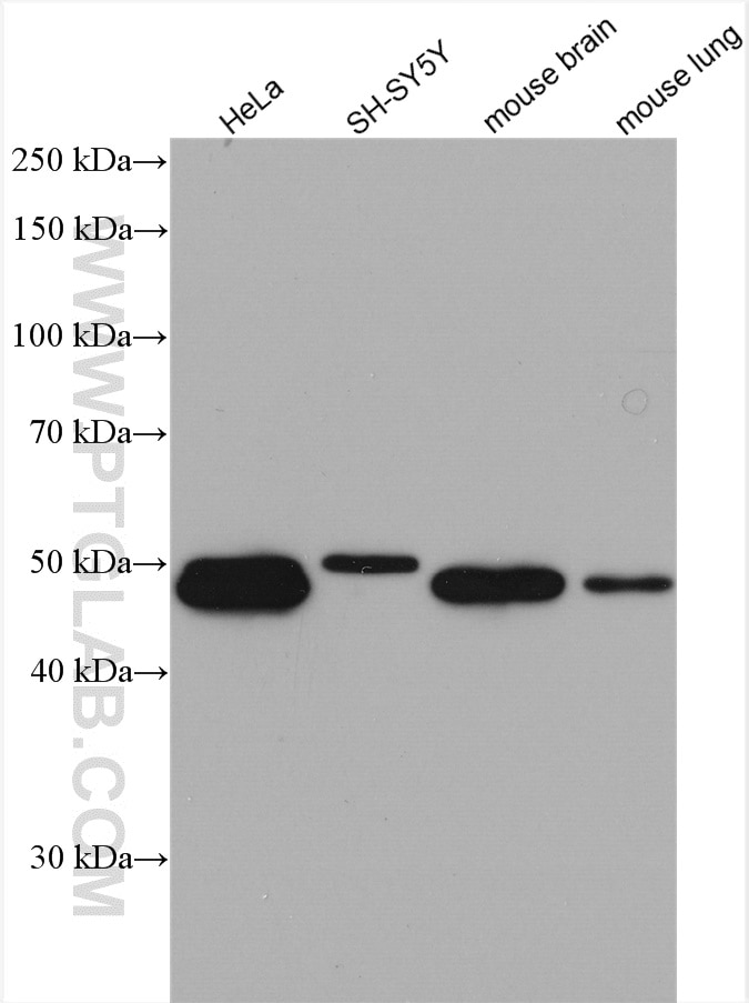 Western Blot (WB) analysis of various lysates using SNX15 Polyclonal antibody (16049-1-AP)